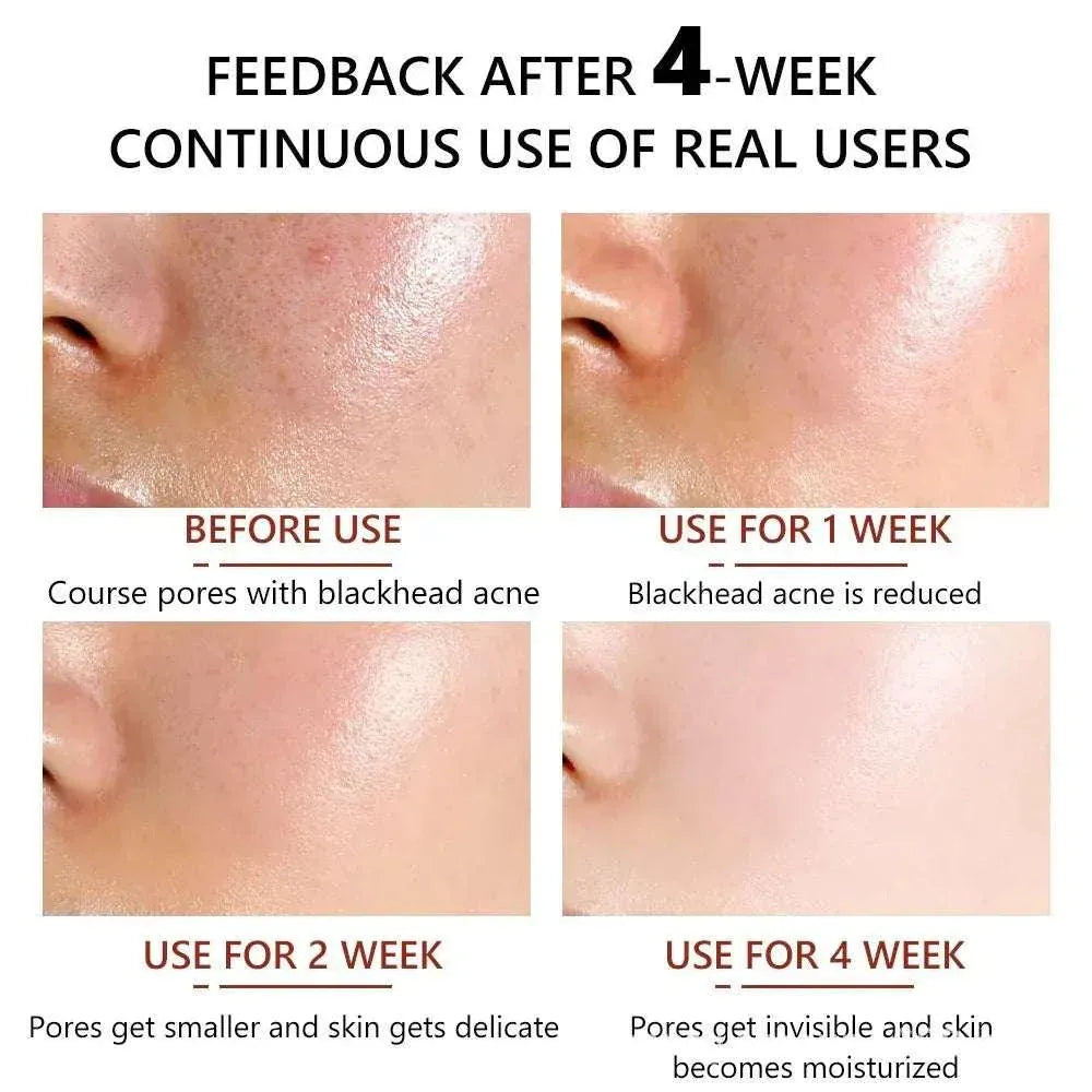 30Ml Cleansing Pore Salicylic Acid - SABR & STYEL