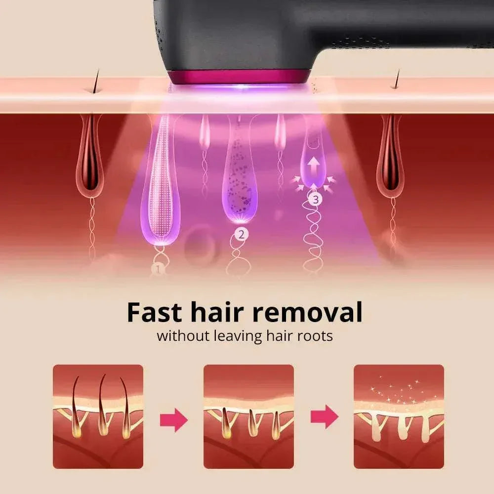 1PCS Laser Hair Removal For Women And Man 100,000 Flashes IPL Painless Laser Hair Removal - SABR & STYEL