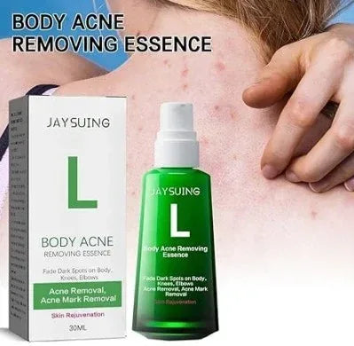 Body Pimple Repair Moisturizer - SABR & STYEL